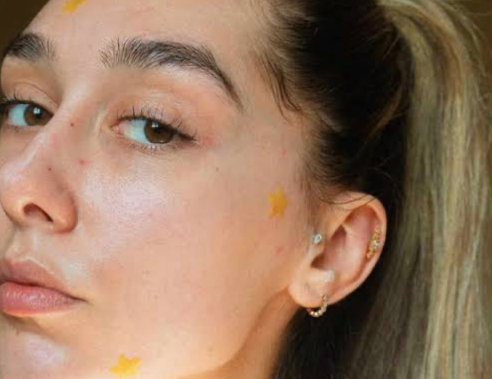 Decoding the Mystery of Breakouts: Unveiling the Causes and Remedies for Clearer Skin